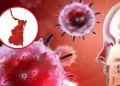 Confirman primera muerte por meningitis en Tamaulipas